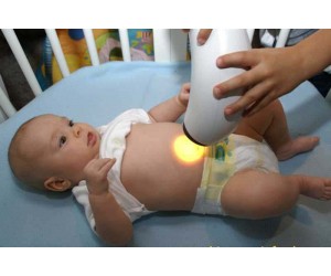 Применение света Биоптрон для новорожденных